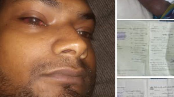 সিলেটে কিডনি রোগে আক্রান্ত ইমরানকে বাঁচতে মায়ের আকুতি - Banglar Mati