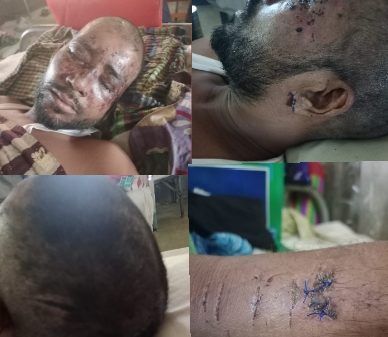 সিলেট শহরতলীর বড়কাপনে প্রবাসীকে মধ্যযোগীয় কায়দায় নির্যাতন! আটক ১ - Banglar Mati