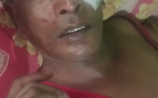 নগরীতে বাসা ভাড়া না দেওয়ার জেরে সাবেক ছাত্রদল সদস্য ফজল বখতের উপর হামলা - Banglar Mati