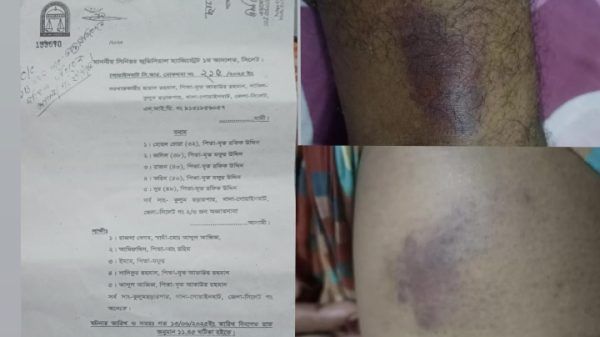 গোয়াইনঘাটে চোরাকারবারি হোছন কতৃক ছায়াদ আলীর উপর হামলা : কোর্টে মামলা - Banglar Mati