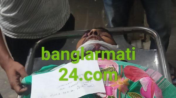 সিলেট- ঢাকা মহাসড়কে দুর্ঘটনায় চালকসহ নিহত ১. আহত ৩ - Banglar Mati