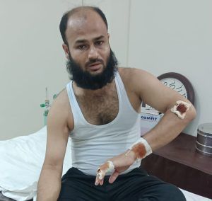 সিলেট নগরীর কোর্ট পয়েন্টে পুলিশের ছররা গুলিতে সাংবাদিক তুরাব নিহত: ৩ জন আহত - Banglar Mati