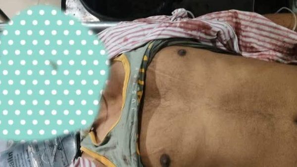 সিলেট নগরীর ক্কিন ব্রিজ এলাকায় প্রকাশ্যে যুবক খু ন - Banglar Mati